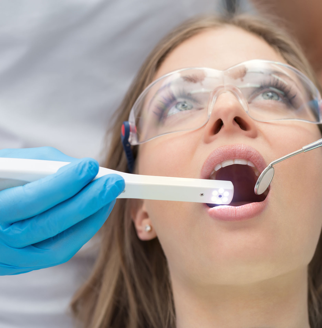 Excelitas has advanced dental imaging and intraoral camera technology through optical innovation Excelitas has advanced dental imaging and intraoral camera technology through optical innovation