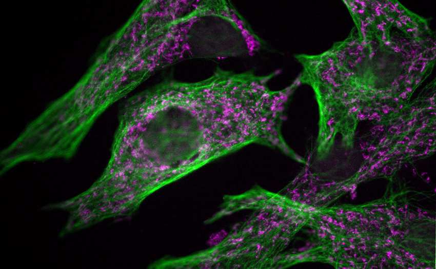 System Components for Laser-Free Confocal Microscopy