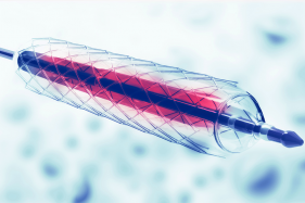 UV Curing of Medical Catheters 