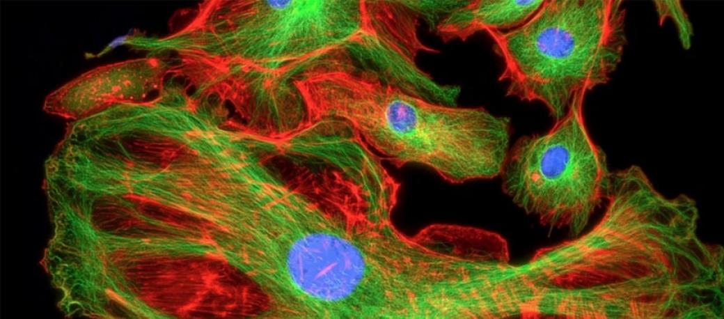 Fluorescence Microscopy