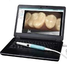 Excelitas USB Dental Camera System