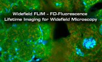 Widefield FLIM - FD-Fluorescence Lifetime Imaging for Widefield Microscopy