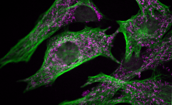 System Components for Laser-Free Confocal Microscopy