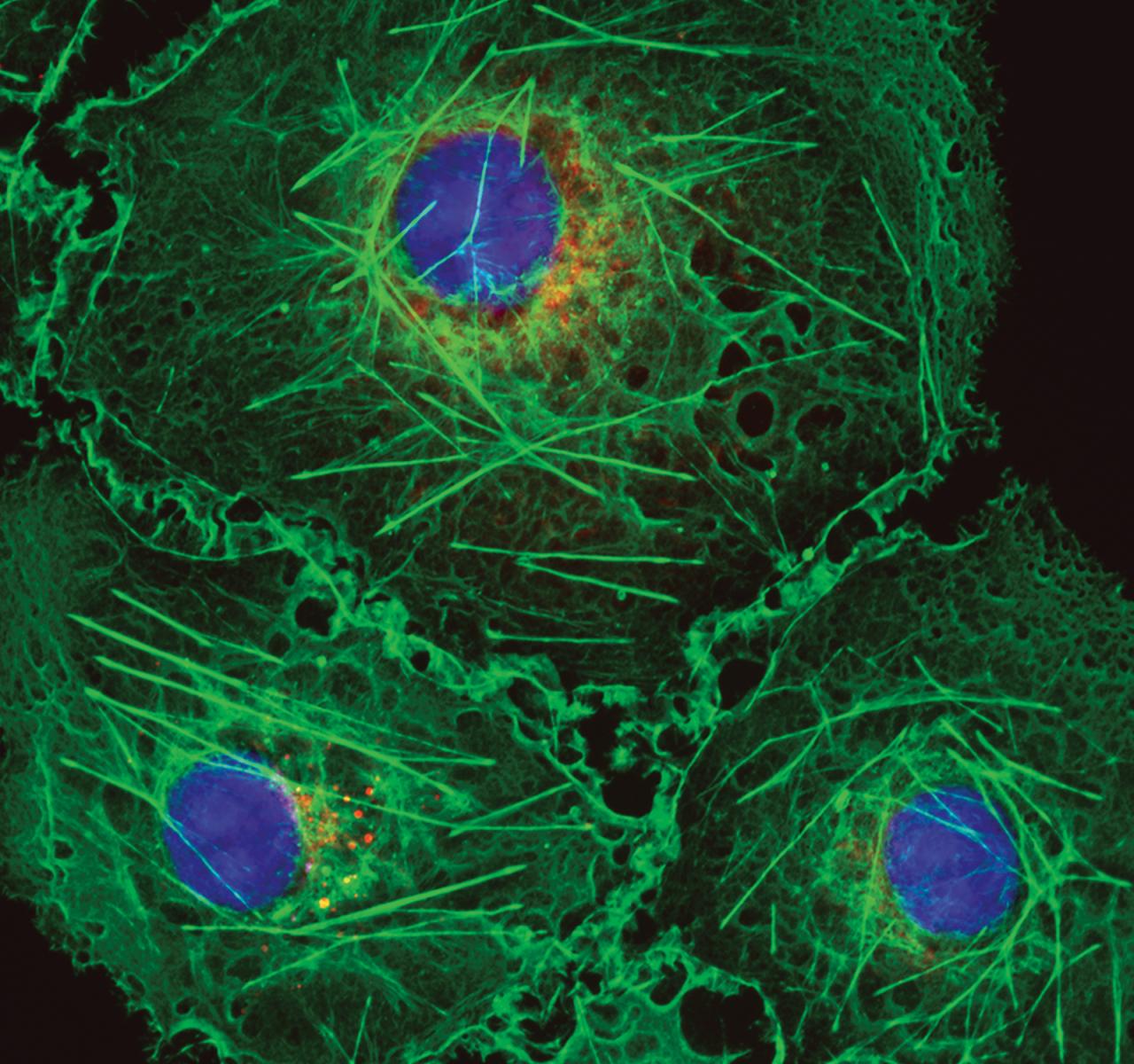 Challenges and Need for Developing Green Wavelength Technology in Life Science Fluorescence Applications