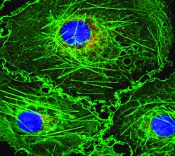 Challenges and Need for Developing Green Wavelength Technology in Life Science Fluorescence Applications